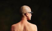 Can Breast Cancer Reoccur After Mastectomy?
