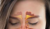 7 Ways To Heal Your Sinuses