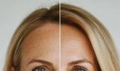 Fend Off Ageing: 7 Secrets To Keep Your Skin Young