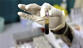 Gilead to allow 5 Indian firms to sell hepatitis generics in 90 countries