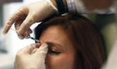 How Allergan plans to boost Botox sales in Indian market