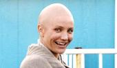 When actors go bald