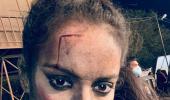 Has Kangana been in a brawl?