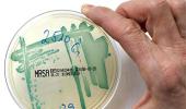 Fear the superbug? Go easy on the antibiotics