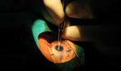 15 lose vision after free cataract surgery in Bihar