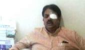 Protesters fling ink at Maharashtra minister