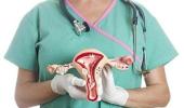 Now, a new treatment for ovarian cancer