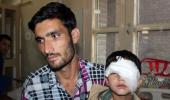 CRPF sorry for pellet injuries in Kashmir