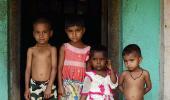 Modi must worry about India's malnutrition crisis