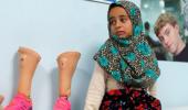 From tin cans to prosthetics: 8-yr-old Syrian takes her first steps