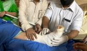 Mamata sustained injuries on ankle, shoulder: Doc