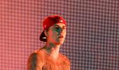 Justin Bieber Has Facial Paralysis