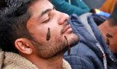 Blood Suckers Turn Healers In Kashmir