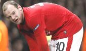 Rooney suffers burst blood vessel in ankle