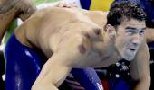 Here's why Phelps has those big red circles all over his back