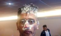 Birthday boy Dhoni under cake-attack!