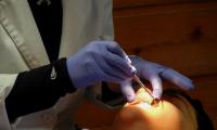 Is It Safe To Remove Your Wisdom Tooth?