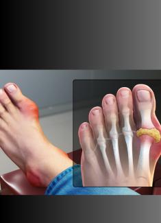webstory image 2