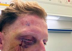Ben Stokes undergoes successful eye surgery