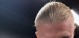 Stitches On Lip, Haaland Hits 5 Goals For Norway!