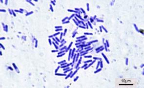 Kerala: First State To Have State 'Bacteria'