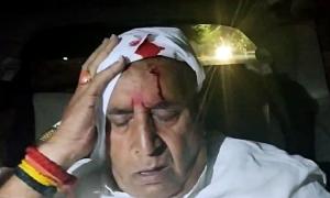 Anil Deshmukh seriously hurt in stone-pelting in Nagpur