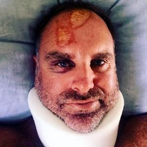 Australia's Hayden fractures neck in surfing accident