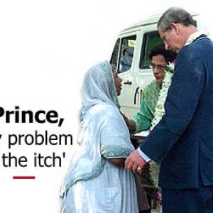 'Prince, my problem is the itch'