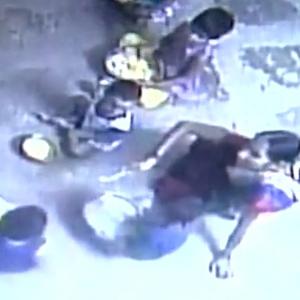 Telangana: Three minors at childcare centre 'burnt' with hot spoons as punishment