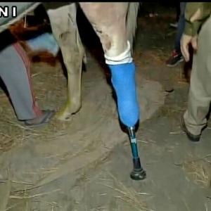 Shaktiman stands on prosthetic limb; amputation successful