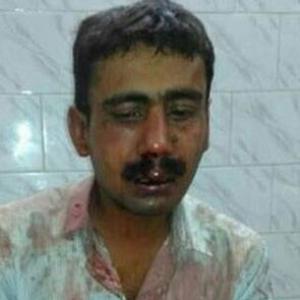 'Telegraph' employee attacked in Patna