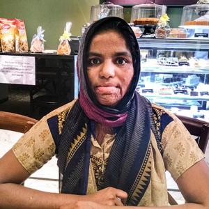 The burn victims who run a cafe