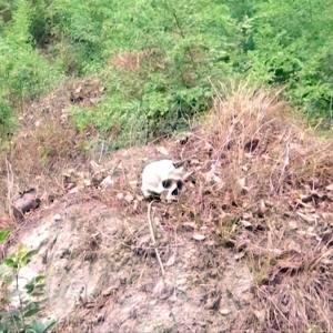 Skull, bones of foetuses discovered in Wardha hospital