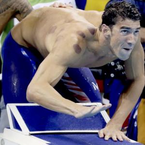Here's why Phelps has those big red circles all over his back
