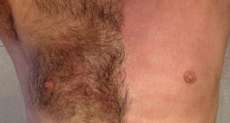 Male body hair: Sexy or not?