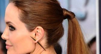 Crash diets, tight ponytails can lead to hair loss?