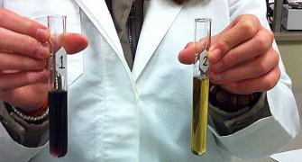 What the colour of your urine says about your health