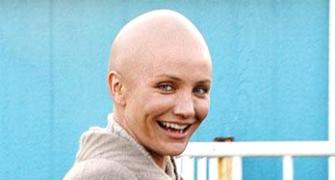 When actors go bald