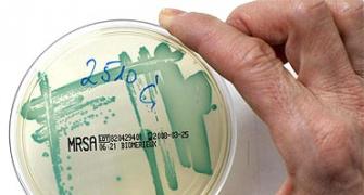 Fear the superbug? Go easy on the antibiotics
