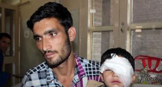 CRPF sorry for pellet injuries in Kashmir