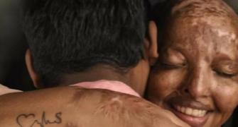 Love triumphs as acid attack survivor gets engaged on Valentine's Day