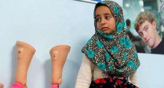 From tin cans to prosthetics: 8-yr-old Syrian takes her first steps
