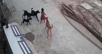 SEE: Minor girl bitten, dragged by stray dogs in MP