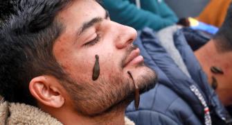 Blood Suckers Turn Healers In Kashmir