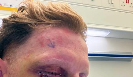 Ben Stokes undergoes successful eye surgery