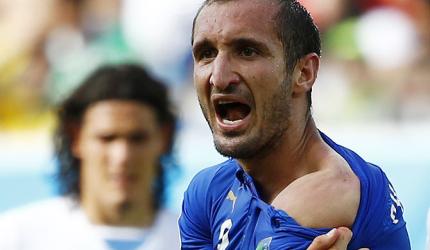 Chiellini admires Suarez for biting him at World Cup