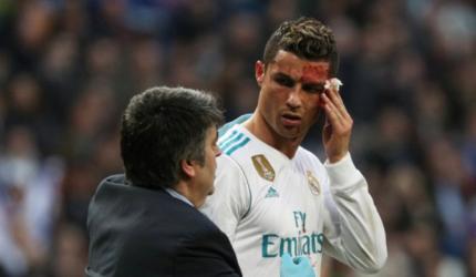 Ronaldo 'still handsome' after face injury
