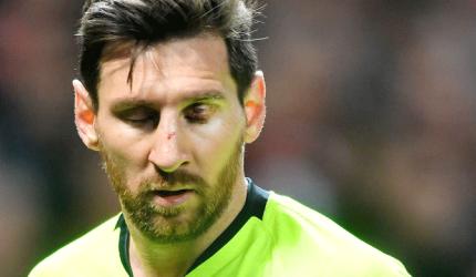 When Messi was left bloodied at Old Trafford