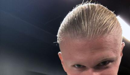 Stitches On Lip, Haaland Hits 5 Goals For Norway!