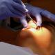 Is It Safe To Remove Your Wisdom Tooth?